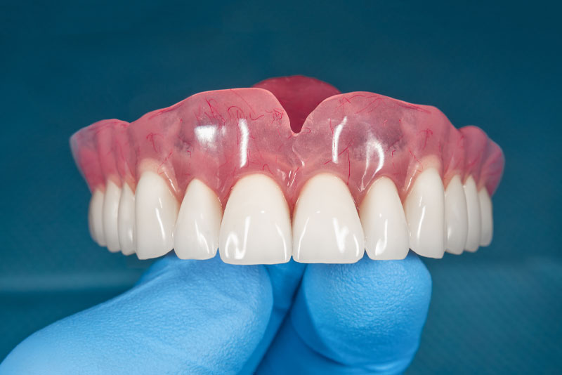 complete dentures model